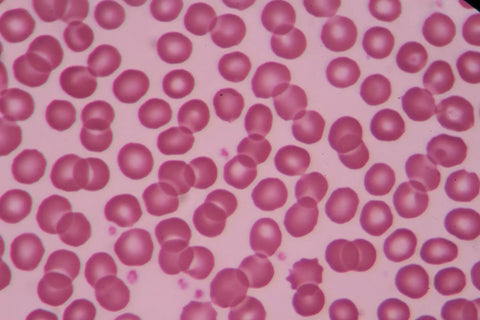 Homocysteine and Hyperhomocysteinemia: Hard to spell. Easy to manage Homocysteine and Hyperhomocysteinemia: Hard