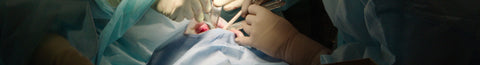 Does Nitrous Oxide Cause Adverse Reactions for People with MTHFR?
