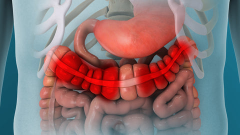 Irritable Bowel Syndrome (IBS), Inflammatory Bowel Disease (IBD) and MTHFR