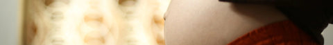 MTHFR and Preeclampsia